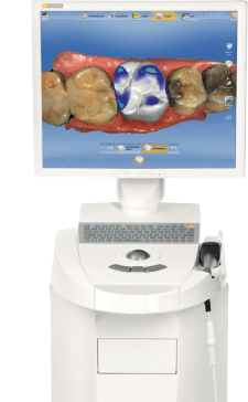 CEREC-Omnicam