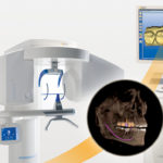 CT scan Digital Scanner