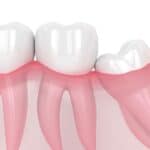 Wisdom Tooth Wisdom Tooth Graphic