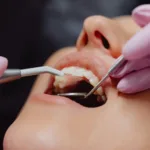teeth cleaning near me